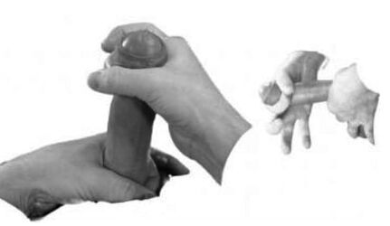 ESGUINCE OF THE PENIS TO INCREASE IT
